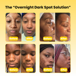 Masque de nuit à l'acide kojique et au curcuma  - Anti taches, fards, bouton, visage gras (PROMO BLACK FRIDAY -60%)