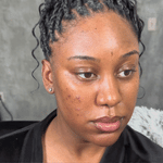 Masque de nuit à l'acide kojique et au curcuma  - Anti taches, fards, bouton, visage gras (PROMO BLACK FRIDAY -60%)